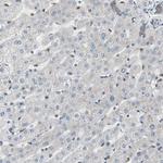 CAMK1D Antibody in Immunohistochemistry (Paraffin) (IHC (P))