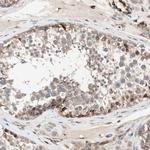 CAMK1D Antibody in Immunohistochemistry (Paraffin) (IHC (P))