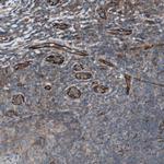 CAMK1D Antibody in Immunohistochemistry (Paraffin) (IHC (P))