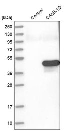 CAMK1D Antibody in Western Blot (WB)