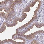 RBP1 Antibody in Immunohistochemistry (Paraffin) (IHC (P))