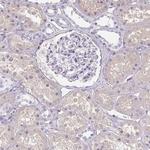 RBP1 Antibody in Immunohistochemistry (Paraffin) (IHC (P))