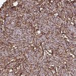 RBP1 Antibody in Immunohistochemistry (Paraffin) (IHC (P))