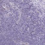 RBP1 Antibody in Immunohistochemistry (Paraffin) (IHC (P))