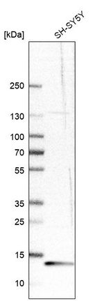 RBP1 Antibody in Western Blot (WB)
