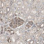 ST2 Antibody in Immunohistochemistry (Paraffin) (IHC (P))