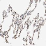 ST2 Antibody in Immunohistochemistry (Paraffin) (IHC (P))