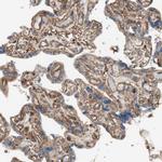 ST2 Polyclonal Antibody