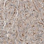 ST2 Antibody in Immunohistochemistry (Paraffin) (IHC (P))