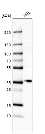ST2 Antibody in Western Blot (WB)