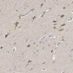 K-cadherin Antibody in Immunohistochemistry (Paraffin) (IHC (P))