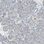K-cadherin Antibody in Immunohistochemistry (Paraffin) (IHC (P))