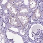 IGF2 Antibody in Immunohistochemistry (Paraffin) (IHC (P))