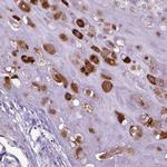 IGF2 Antibody in Immunohistochemistry (Paraffin) (IHC (P))