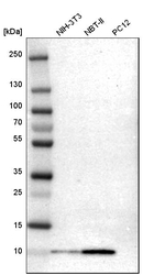 S100A6 Antibody in Western Blot (WB)