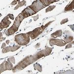 HIPK2 Polyclonal Antibody