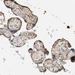 TAOK1 Antibody in Immunohistochemistry (Paraffin) (IHC (P))