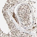 TAOK1 Antibody in Immunohistochemistry (Paraffin) (IHC (P))