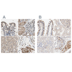 Protein S Polyclonal Antibody