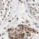 Protein S Antibody in Immunohistochemistry (Paraffin) (IHC (P))