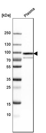 Protein S Antibody in Western Blot (WB)