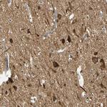 MAGI3 Antibody in Immunohistochemistry (Paraffin) (IHC (P))