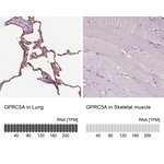 RAI3 Antibody in Immunohistochemistry (Paraffin) (IHC (P))