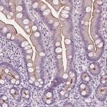 RAI3 Antibody in Immunohistochemistry (Paraffin) (IHC (P))