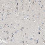 MARK1 Polyclonal Antibody