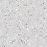 RON Antibody in Immunohistochemistry (Paraffin) (IHC (P))