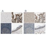 RON Antibody in Immunohistochemistry (Paraffin) (IHC (P))