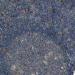 RON Antibody in Immunohistochemistry (Paraffin) (IHC (P))