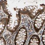RON Antibody in Immunohistochemistry (Paraffin) (IHC (P))