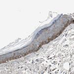 RON Antibody in Immunohistochemistry (Paraffin) (IHC (P))