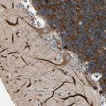 MAP2 Antibody in Immunohistochemistry (Paraffin) (IHC (P))