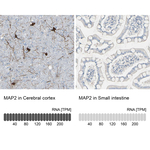 MAP2 Antibody in Immunohistochemistry (Paraffin) (IHC (P))