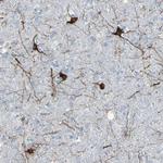 MAP2 Antibody in Immunohistochemistry (Paraffin) (IHC (P))