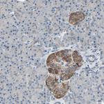 MAP2 Antibody in Immunohistochemistry (Paraffin) (IHC (P))