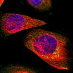 SUN3 Polyclonal Antibody