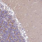 Synaptotagmin 1 Antibody in Immunohistochemistry (Paraffin) (IHC (P))