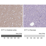 Synaptotagmin 1 Antibody in Immunohistochemistry (Paraffin) (IHC (P))