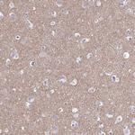 Synaptotagmin 1 Antibody in Immunohistochemistry (Paraffin) (IHC (P))
