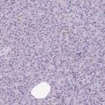 Synaptotagmin 1 Antibody in Immunohistochemistry (Paraffin) (IHC (P))
