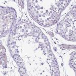 Synaptotagmin 1 Antibody in Immunohistochemistry (Paraffin) (IHC (P))