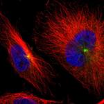 AKAP9 Polyclonal Antibody