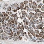 AKAP9 Antibody in Immunohistochemistry (Paraffin) (IHC (P))