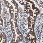 MUTYH Antibody in Immunohistochemistry (Paraffin) (IHC (P))