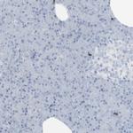CD3z Antibody in Immunohistochemistry (Paraffin) (IHC (P))