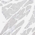 CD3z Antibody in Immunohistochemistry (Paraffin) (IHC (P))