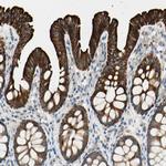DUSP12 Polyclonal Antibody